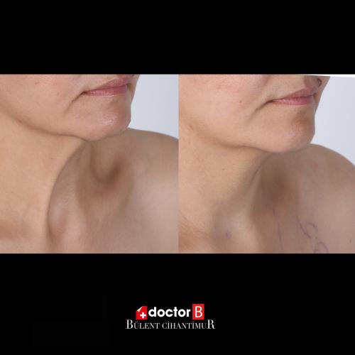 Before after photos of our patients 3